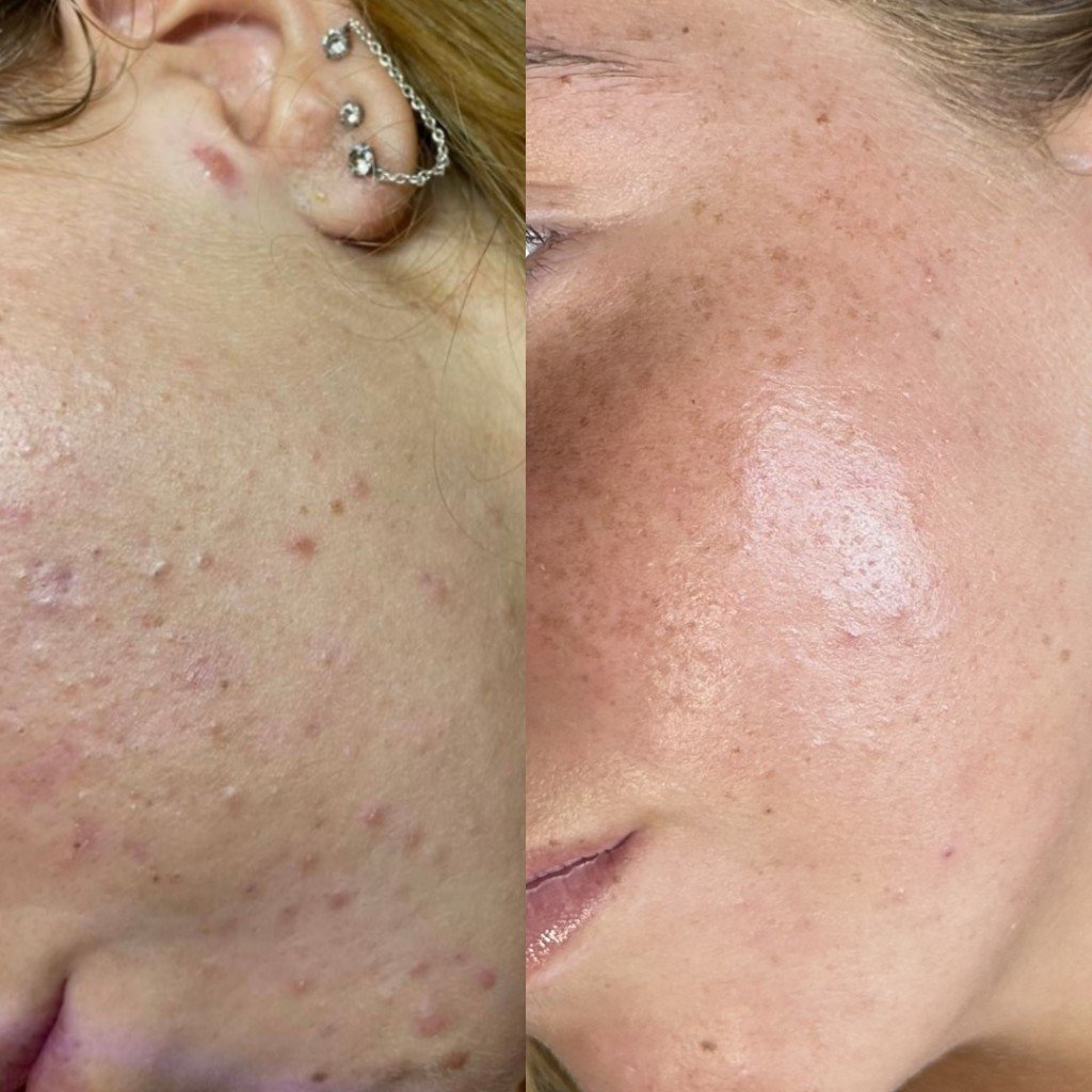 השוואת לפני ואחרי טיפול